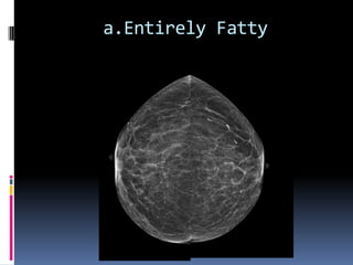 a.Entirely Fatty
 