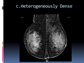 c.Heterogeneously Dense
 