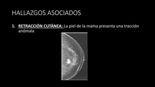 HALLAZGOS ASOCIADOS
1. RETRACCIÓN CUTÁNEA: La piel de la mama presenta una tracción
anómala
 