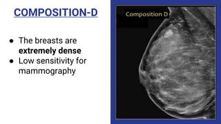 COMPOSITION-D
● The breasts are
extremely dense
● Low sensitivity for
mammography
 