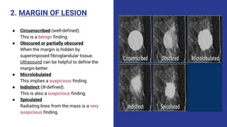 2. MARGIN OF LESION
● Circumscribed (well-defined).
This is a benign finding.
● Obscured or partially obscured
When the margin is hidden by
superimposed fibroglandular tissue.
Ultrasound can be helpful to define the
margin better.
● Microlobulated
This implies a suspicious finding.
● Indistinct (ill-defined).
This is also a suspicious finding.
● Spiculated
Radiating lines from the mass is a very
suspicious finding.
 
