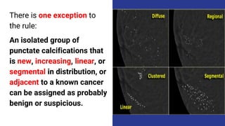 There is one exception to
the rule:
An isolated group of
punctate calcifications that
is new, increasing, linear, or
segmental in distribution, or
adjacent to a known cancer
can be assigned as probably
benign or suspicious.
 