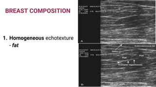 BREAST COMPOSITION
1. Homogeneous echotexture
- fat
 