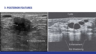 3. POSTERIOR FEATURES
 