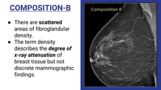 COMPOSITION-B
● There are scattered
areas of fibroglandular
density.
● The term density
describes the degree of
x-ray attenuation of
breast tissue but not
discrete mammographic
findings.
 
