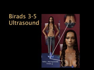 Birads 3-5  Ultrasound 