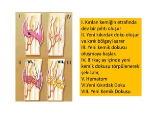 Kemiklere sağlamlığını veren resimde gördüğünüz bu
kafes gibi yapı, binaların sağlam olması için de kullanılır.
Kemiklerin iç yapısına benzetilerek inşa edilen Eyfel Kulesi
böyle binalara bir örnektir.
 