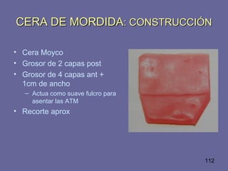 112
CERA DE MORDIDACERA DE MORDIDA: CONSTRUCCIÓN: CONSTRUCCIÓN
• Cera Moyco
• Grosor de 2 capas post
• Grosor de 4 capas ant +
1cm de ancho
– Actua como suave fulcro para
asentar las ATM
• Recorte aprox
 