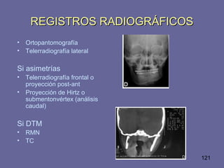 121
REGISTROS RADIOGRÁFICOSREGISTROS RADIOGRÁFICOS
• Ortopantomografía
• Telerradiografía lateral
Si asimetrías
• Telerradiografía frontal o
proyección post-ant
• Proyección de Hirtz o
submentonvértex (análisis
caudal)
Si DTM
• RMN
• TC
 