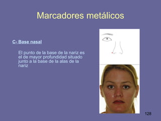 128
C- Base nasal
El punto de la base de la nariz es
el de mayor profundidad situado
junto a la base de la alas de la
nariz
Marcadores metálicos
 