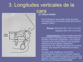 149
3.7 Altura maxilar
Es la distancia que existe entre el punto
subnasal (Sn) y el borde incisal del incisivo
superior (Mx1)
Norma: Hombres 25,7 mm + 2,1 mm
Mujeres 28,4 mm + 3,2 mm
Interpretación: Esta medida describe
el crecimiento dentoalveolar vertical de los
dientes anteriores superiores. Los valores
mayores a la norma indican una erupción
excesiva de los dientes anteriores
superiores, los valores menores a la norma
indican una erupción deficiente de estos
dientes.
Cuando esta medida se encuentra
aumentada se trata de un exceso vertical
del maxilar, pudiendo presentar una sonrisa
gingival, siempre y cuando la dimensión del
labio no se encuentre aumentada.
3. Longitudes verticales de la
cara
 