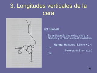 151
3.9 Glabela
Es la distancia que existe entre la
Glabela y el plano vertical verdadero
Norma: Hombres -8,5mm + 2,4
mm
Mujeres -8,5 mm + 2,0
mm
3. Longitudes verticales de la
cara
 