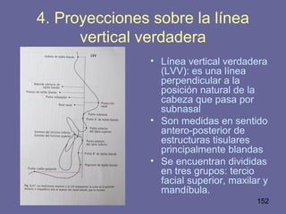 152
4. Proyecciones sobre la línea
vertical verdadera
• Línea vertical verdadera
(LVV): es una línea
perpendicular a la
posición natural de la
cabeza que pasa por
subnasal
• Son medidas en sentido
antero-posterior de
estructuras tisulares
principalmente blandas
• Se encuentran divididas
en tres grupos: tercio
facial superior, maxilar y
mandíbula.
 