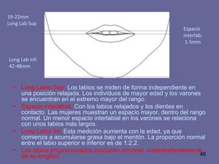 46
• Long Labio Sup: Los labios se miden de forma independiente en
una posición relajada. Los individuos de mayor edad y los varones
se encuentran en el extremo mayor del rango.
• Espacio interlabial: Con los labios relajados y los dientes en
contacto. Las mujeres muestran un espacio mayor, dentro del rango
normal. Un menor espacio interlabial en los varones se relaciona
con unos labios más largos.
• Long Labio Inf: Esta medición aumenta con la edad, ya que
comienza a acumularse grasa bajo el mentón. La proporción normal
entre el labio superior e inferior es de 1:2,2.
• Los labios proporcionados producen armonía, independientemente
de su longitud.
19-22mm
Long Lab Sup
Espacio
interlab:
1-5mm
Long Lab Inf:
42-48mm
 