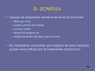 59
• Causas de exposición excesiva de la encía al sonreír
– labio sup corto
– exceso vertical del maxilar
– coronas cortas
– hipertrofía gingival y/o
– amplia elevación del labio sup al sonreír.
• Es interesante comprobar que ninguno de estos factores
puede verse influido por el tratamiento ortodóncico.
B- SONRISAB- SONRISA
 