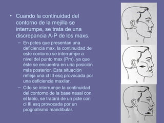 72
• Cuando la continuidad del
contorno de la mejilla se
interrumpe, se trata de una
discrepancia A-P de los maxs.
– En pctes que presentan una
deficiencia max, la continuidad de
este contorno se interrumpe a
nivel del punto max (Pm), ya que
éste se encuentra en una posición
más posterior. Esta situación
refleja una cl III esq provocada por
una deficiencia maxilar.
– Cdo se interrumpe la continuidad
del contorno de la base nasal con
el labio, se tratará de un pcte con
cl III esq provocada por un
prognatismo mandibular.
 