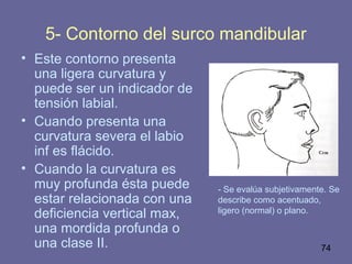 74
5- Contorno del surco mandibular
• Este contorno presenta
una ligera curvatura y
puede ser un indicador de
tensión labial.
• Cuando presenta una
curvatura severa el labio
inf es flácido.
• Cuando la curvatura es
muy profunda ésta puede
estar relacionada con una
deficiencia vertical max,
una mordida profunda o
una clase II.
- Se evalúa subjetivamente. Se
describe como acentuado,
ligero (normal) o plano.
 