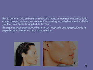 78
Por lo general, cdo se hace un retroceso mand es necesario acompañarlo
con un desplazamiento ant del mentón para lograr un balance entre el labio
y el Me y mantener la longitud de la mand.
En algunas ocasiones puede llegar a ser necesaria una liposucción de la
papada para obtener un perfil más estético.
 