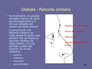 82
Glabela - Reborde orbitario
• Normalmente, la glabela
de tejido blando se sitúa
aproximadamente a 2
mm por delante del
nasion de tejido blando.
• La proyección del
reborde orbitario se
mide desde la parte más
anterior del ojo hasta el
reborde orbitario de
tejido blando, el cual
también puede ser
descrito de forma
subjetiva
– «plano»
– «blando»
– «normal»
– «prominente»
Glabela de tejido blando
Nasion de tej blando
Globo ocular
Reborde orbitario de tej
blando
 