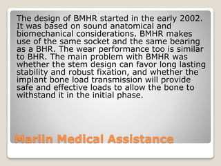 Using Bhr Machine Birmingham hip-resurfacing | PPTX