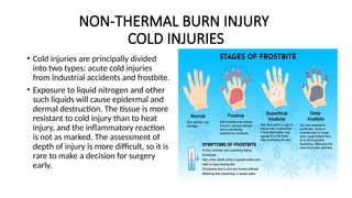 Comprehensive Overview of Burns, Frostbite, and Electrical Injuries ...