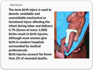 birth.injuries in high risk neonates like | PPTX