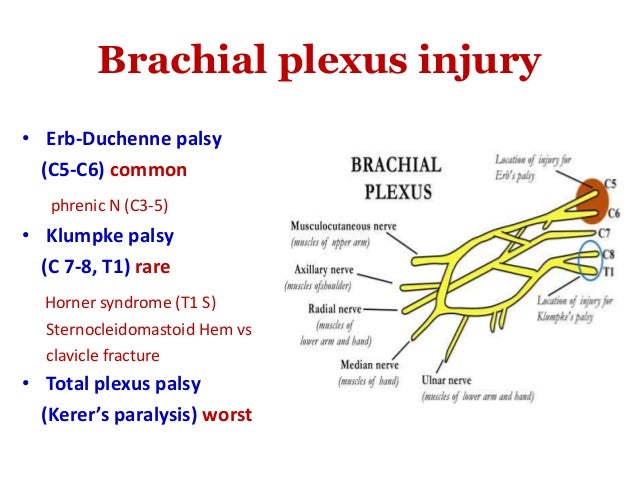 erb duchenne