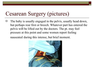 Cesarean Surgery (pictures)
   The baby is usually engaged in the pelvis, usually head down,
    but perhaps rear first or breech. Whatever part has entered the
    pelvis will be lifted out by the doctors. The pt. may feel
    pressure at this point and some women report feeling
    nauseated during this intense, but brief moment.
 