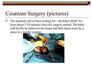 Cesarean Surgery (pictures)
   The moment you've been waiting for - the baby's birth! It's
    been about 5-10 minutes since the surgery started. The baby
    will briefly be held over the drape and then taken away by a
    nurse to a nearby warmer.
 