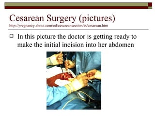 Cesarean Surgery (pictures)
http://pregnancy.about.com/od/cesareansection/ss/cesarean.htm

   In this picture the doctor is getting ready to
    make the initial incision into her abdomen
 