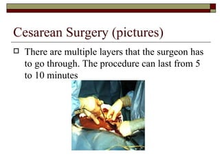 Cesarean Surgery (pictures)
   There are multiple layers that the surgeon has
    to go through. The procedure can last from 5
    to 10 minutes
 