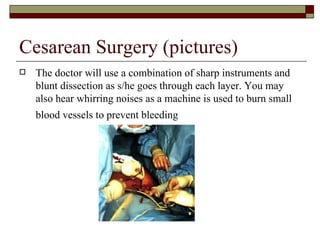 Cesarean Surgery (pictures)
   The doctor will use a combination of sharp instruments and
    blunt dissection as s/he goes through each layer. You may
    also hear whirring noises as a machine is used to burn small
    blood vessels to prevent bleeding
 