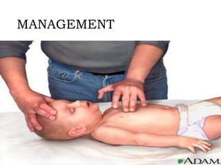 MANAGEMENT
 