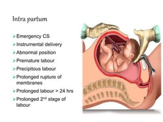 Intra partum
Emergency CS
Instrumental delivery
Abnormal position
Premature labour
Precipitous labour
Prolonged rupture of
membranes
Prolonged labour > 24 hrs
Prolonged 2nd stage of
labour
 
