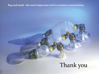Bag and mask –the most important tool in newborn resuscitationThank you