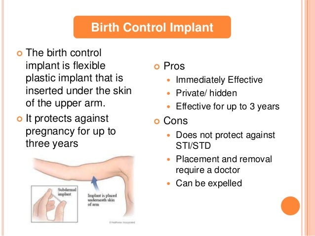 Pros And Cons On Birth Control