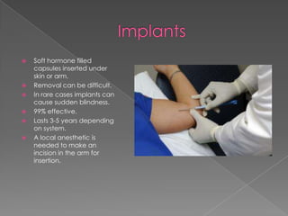 ImplantsSoft hormone filled capsules inserted under skin or arm.Removal can be difficult.In rare cases implants can cause sudden blindness. 99% effective.Lasts 3-5 years depending on system.A local anesthetic is needed to make an incision in the arm for insertion.
