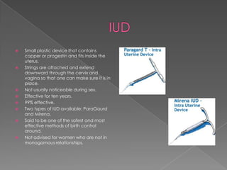 IUDSmall plastic device that contains copper or progestin and fits inside the uterus.Strings are attached and extend downward through the cervix and vagina so that one can make sure it is in place.Not usually noticeable during sex.Effective for ten years.99% effective.Two types of IUD available: ParaGaurd and Mirena. Said to be one of the safest and most effective methods of birth control around.Not advised for women who are not in monogamous relationships. 