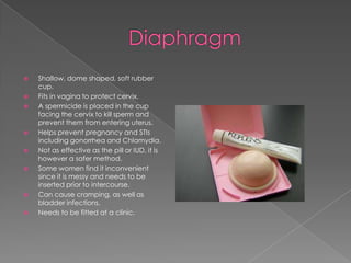 DiaphragmShallow, dome shaped, soft rubber cup.Fits in vagina to protect cervix.A spermicide is placed in the cup facing the cervix to kill sperm and prevent them from entering uterus. Helps prevent pregnancy and STIs including gonorrhea and Chlamydia.Not as effective as the pill or IUD, it is however a safer method.Some women find it inconvenient since it is messy and needs to be inserted prior to intercourse. Can cause cramping, as well as bladder infections.Needs to be fitted at a clinic.