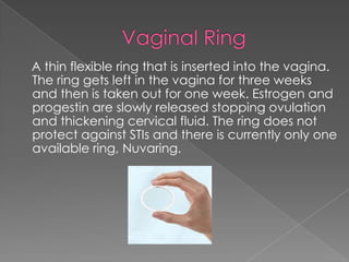 Vaginal Ring    A thin flexible ring that is inserted into the vagina. The ring gets left in the vagina for three weeks and then is taken out for one week. Estrogen and progestin are slowly released stopping ovulation and thickening cervical fluid. The ring does not protect against STIs and there is currently only one available ring, Nuvaring.