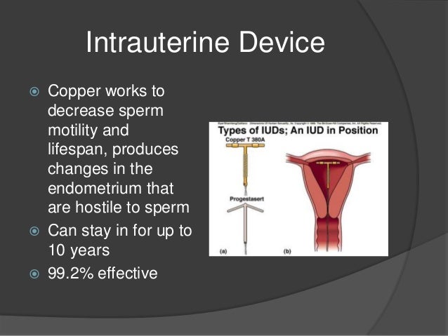 intrauterine device ppt Intra uterine devices.