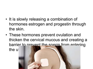 • It is slowly releasing a combination of
hormones estrogen and progestin through
the skin.
• These hormones prevent ovulation and
thicken the cervical mucous and creating a
barrier to prevent the sperm from entering
the uterus.
 