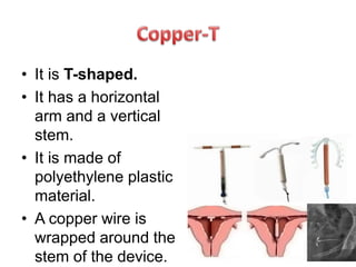 • It is T-shaped.
• It has a horizontal
arm and a vertical
stem.
• It is made of
polyethylene plastic
material.
• A copper wire is
wrapped around the
stem of the device.
 
