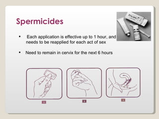 Spermicides
   Each application is effective up to 1 hour, and
    needs to be reapplied for each act of sex

   Need to remain in cervix for the next 6 hours
 