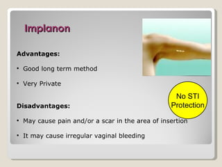 Implanon

Advantages:

   Good long term method

   Very Private

                                                    No STI
Disadvantages:                                     Protection
   May cause pain and/or a scar in the area of insertion

   It may cause irregular vaginal bleeding
 