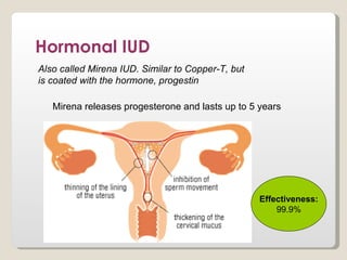 Hormonal IUD
Also called Mirena IUD. Similar to Copper-T, but
is coated with the hormone, progestin

   Mirena releases progesterone and lasts up to 5 years




                                                   Effectiveness:
                                                       99.9%
 