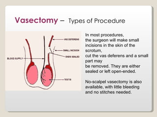 Vasectomy –   Types of Procedure

                   In most procedures,
                   the surgeon will make small
                   incisions in the skin of the
                   scrotum,
                   cut the vas deferens and a small
                   part may
                   be removed. They are either
                   sealed or left open-ended.

                   No-scalpel vasectomy is also
                   available, with little bleeding
                   and no stitches needed.
 
