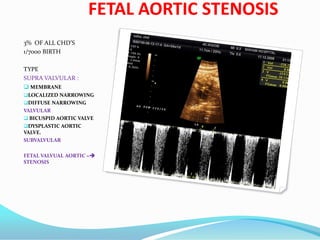 FETAL AORTIC STENOSIS
3% OF ALL CHD’S
1/7000 BIRTH
TYPE
SUPRA VALVULAR :
 MEMBRANE
LOCALIZED NARROWING
DIFFUSE NARROWING
VALVULAR
 BICUSPID AORTIC VALVE
DYSPLASTIC AORTIC
VALVE.
SUBVALVULAR
FETAL VALVUAL AORTIC =
STENOSIS
 