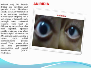 ANIRIDIAAniridia may be broadly
divided into hereditary and
sporadic forms. Hereditary
aniridia is usually transmitted
in an autosomal dominant
manner (each offspring has a
50% chance of being affected),
although rarer autosomal
recessive forms (such as
Gillespie syndrome) have also
been reported. Sporadic
aniridia mutations may affect
the WT1 region adjacent to the
AN2 aniridia region, causing a
kidney cancer called
nephroblastoma (Wilms
tumor). These patients often
also have genitourinary
abnormalities and mental
retardation (WAGR
syndrome).
 