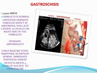 GASTROSCHISIS
1/4000 BIRTH
UMBILICUS IS NORMAL
INTESTINE HERNIATE
THROUGH DEFECT IN
ABDOMINAL WALL JUST
LATERAL & USUALLY ON
RIGHT SIDE OF THE
UMBILICUS
SPORADIC
ABNORMALITY
CHILD REQUIRE TOTAL
PARENTRAL NUTRITION
DURING IMMEDIATE
POSTNATAL PERIOD
DEATH IS AROUD 4
YEARS OF AGE DUE TO
LIVER FAILURE
 